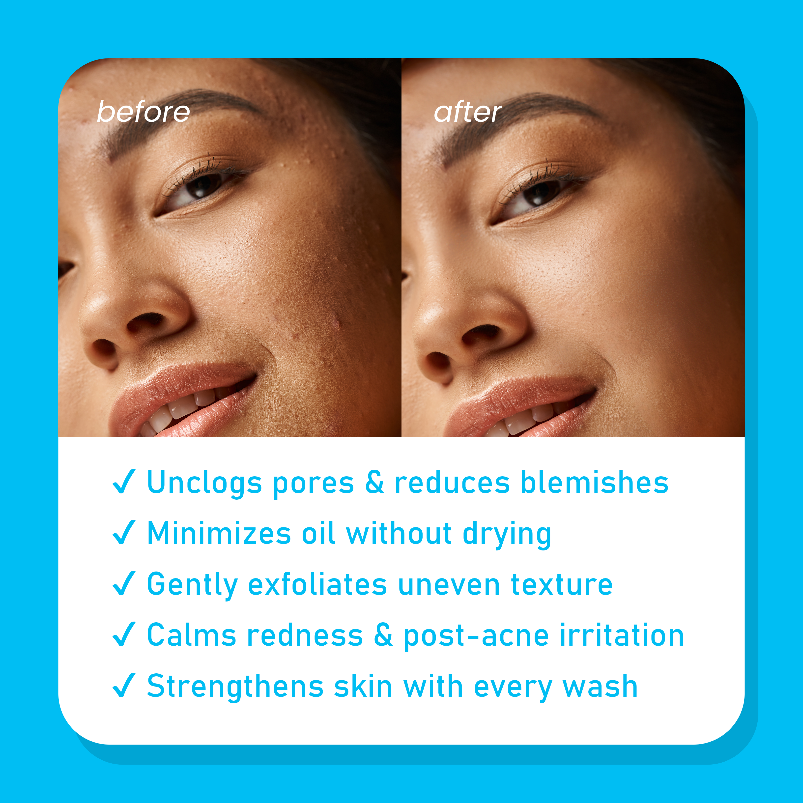 Foaming Face Wash – 100 ml