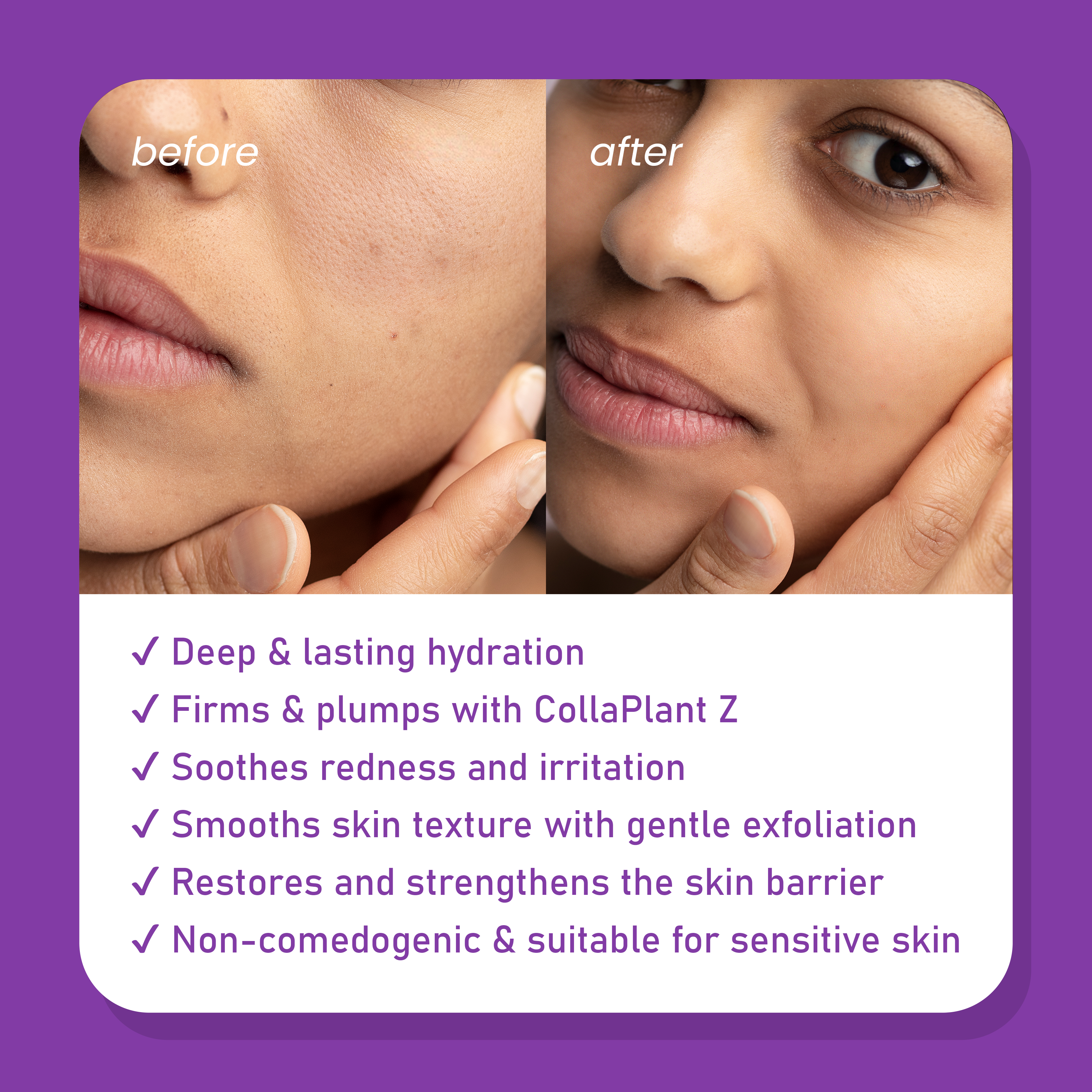 Moisturizer – 50 gm