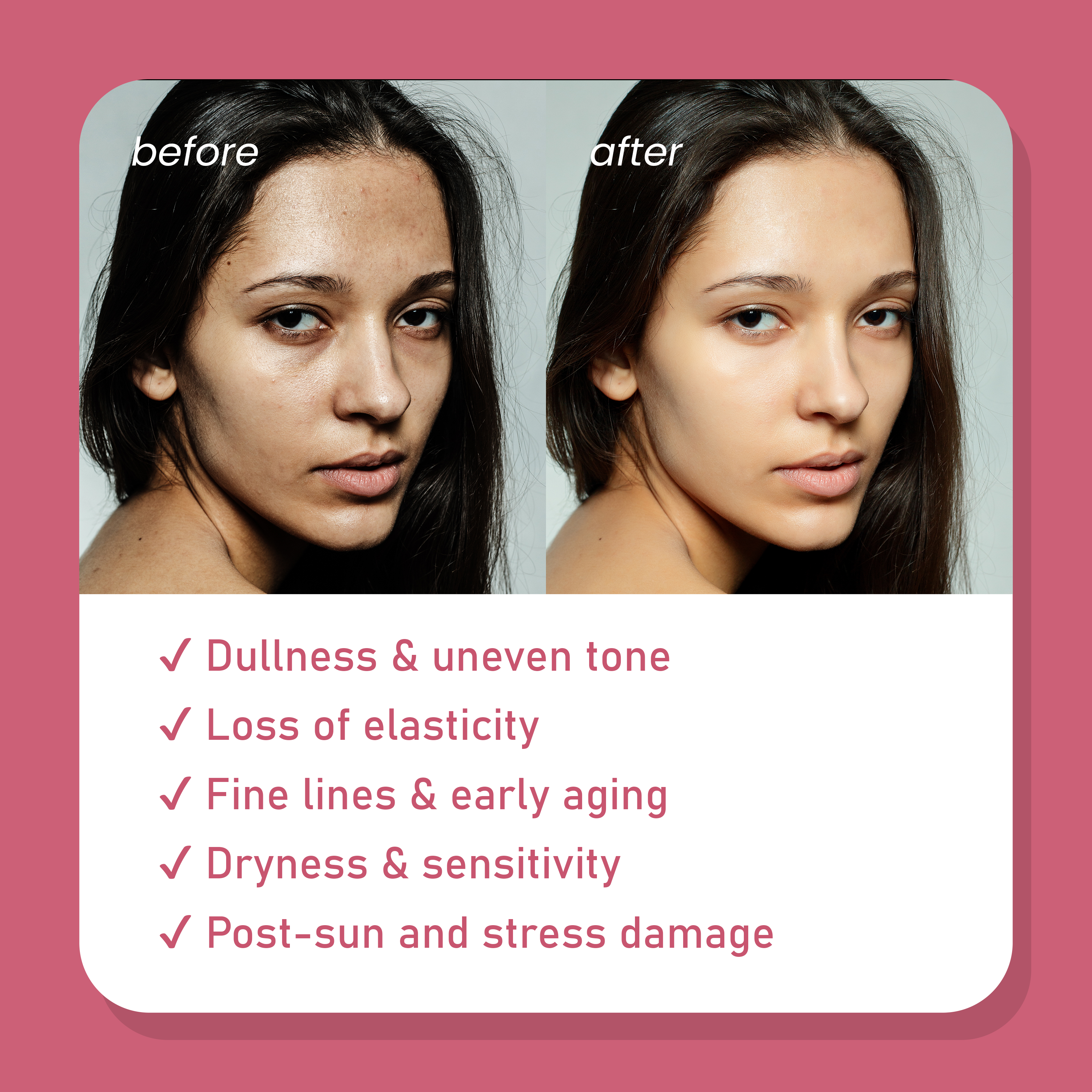 Face Serum – 30ml
